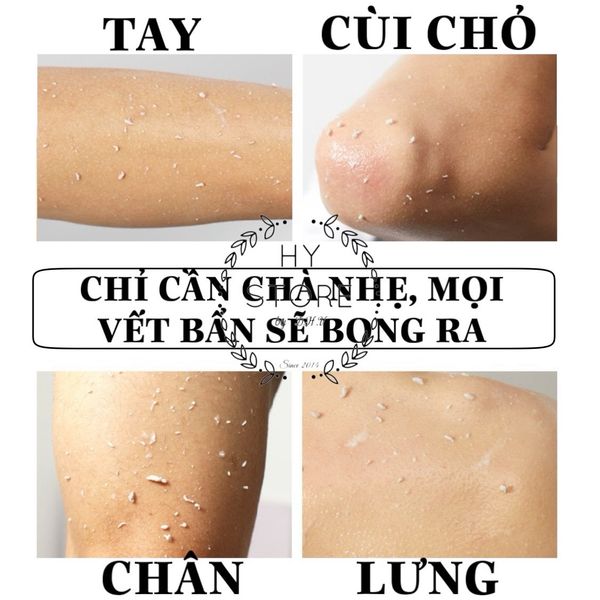 Gel tẩy tế bào chết