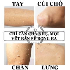 Gel tẩy tế bào chết