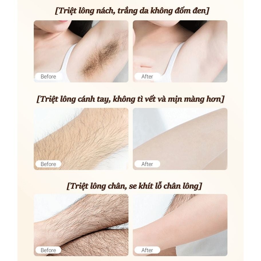 Kem tẩy lông SADOER, tẩy lông vùng kín không đau