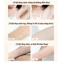 Kem tẩy lông SADOER, tẩy lông vùng kín không đau