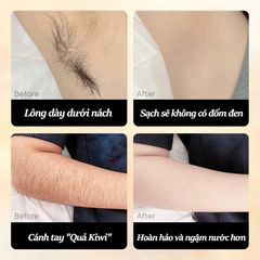 Kem tẩy lông SADOER, tẩy lông vùng kín không đau