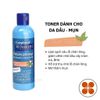Gel Rửa Mặt & Toner Giảm Mụn Compliment No Problem 200ml
