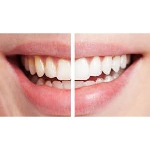 Kem đánh răng White & White Nhật Lion 150g