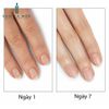 Dưỡng phục hồi móng CND RescueRXx 3,7ml ( Mỹ ) - Cải thiện hư tổn, kích thích mọc móng