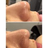  Ủ Mụn Đầu Đen Removes BlackHeads Hỗ Trợ Giảm Sợi Bã Nhờn 50ml 