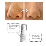  Ủ Mụn Đầu Đen Removes BlackHeads Hỗ Trợ Giảm Sợi Bã Nhờn 50ml 