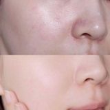  [Date 07/2023] Serum Skin1004 Cấp Ẩm, Làm Dịu & Dưỡng Sáng Da 50ml 