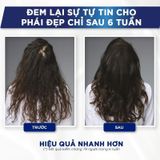  Tinh Chất L'Oréal Professionnel Kích Thích Mọc Tóc 90ml Serioxyl Denser Hair 