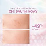  Kem Dưỡng L'Oreal Paris Sáng Mịn Mờ Thâm Nám Ban Đêm 15ml 