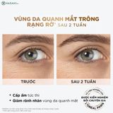  Serum L'Oreal Giảm Bọng Mắt & Làm Đầy Rãnh Nhăn 20ml 