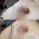  Ủ Mụn Đầu Đen Removes BlackHeads Hỗ Trợ Giảm Sợi Bã Nhờn 50ml 
