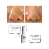  Ủ Mụn Đầu Đen Removes BlackHeads Hỗ Trợ Giảm Sợi Bã Nhờn 50ml 