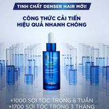  Tinh Chất L'Oréal Professionnel Kích Thích Mọc Tóc 90ml Serioxyl Denser Hair 