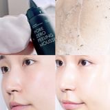  Tẩy Da Chết Neogen Dạng Bọt Mịn BHA Làm Sạch Sâu 100ml 