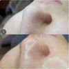  Ủ Mụn Đầu Đen Removes BlackHeads Hỗ Trợ Giảm Sợi Bã Nhờn 50ml 