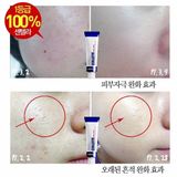  [HCM]Kem Giảm Mụn Phục Hồi Da Medi-Peel Centella Mezzo Cream 30ml 