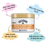  Kem Dưỡng Da Gold Bond Ultimate Rough & Bumpy Skin Cream 226G 