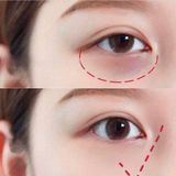  Kem Dưỡng Mắt Advanced Night Repair 3ml - 5ml - 15ml 