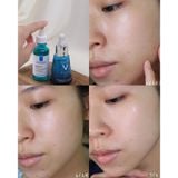  Tinh Chất La Roche-Posay Effaclar Serum Giảm Mụn 3 Tác Động 30ml 