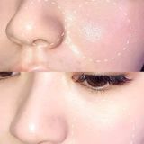  Dung Dịch Tẩy Da Chết Giảm Mụn Clenziderm M.D. Pore Therapy 148ml 