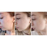  Gel Dưỡng Giúp Phục Hồi Cicaplast Gel B5 Epidermal Recovery Accelerator Skincare 40ml 