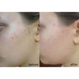  Kem Dưỡng SVR Kiềm Dầu Se Lỗ Chân Lông Sebiaclear Mat+Pores 40ml 