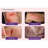  Bioderma - Kem Dưỡng Bioderma Hỗ Trợ Phục Hồi Và Làm Dịu Da Cicabio Creme 