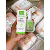  Serum Martiderm Acniover Giảm Mụn & Kiểm Soát Nhờn 30ml 