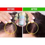  Tinh Chất mọc tóc Sato Arovics Solutions 5% Nhật Bản 30ml 