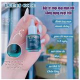  Serum Lumos Acne Hỗ Trợ Giảm Mụn, Giảm Dầu Nhờn 5ml 