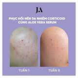  Tinh chất lô hội ALOE VERA SERUM - Juliette Armand 