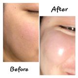  SERUM SMAS HA PLUS HYALURONIC ACID 100ML 