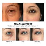  Kem Mắt Lancome Advanced Genefique 5ml 