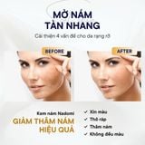 Kem Dưỡng Trắng Da Mờ Thâm Nám Thảo Dược Đông Y Nadomi Hàn Quốc, Kem Dưỡng Nám Hàn Quốc Dung Tích 80g