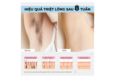 Máy triệt lông lạnh cá nhân Halio IPL Cooling Hair Removal Device