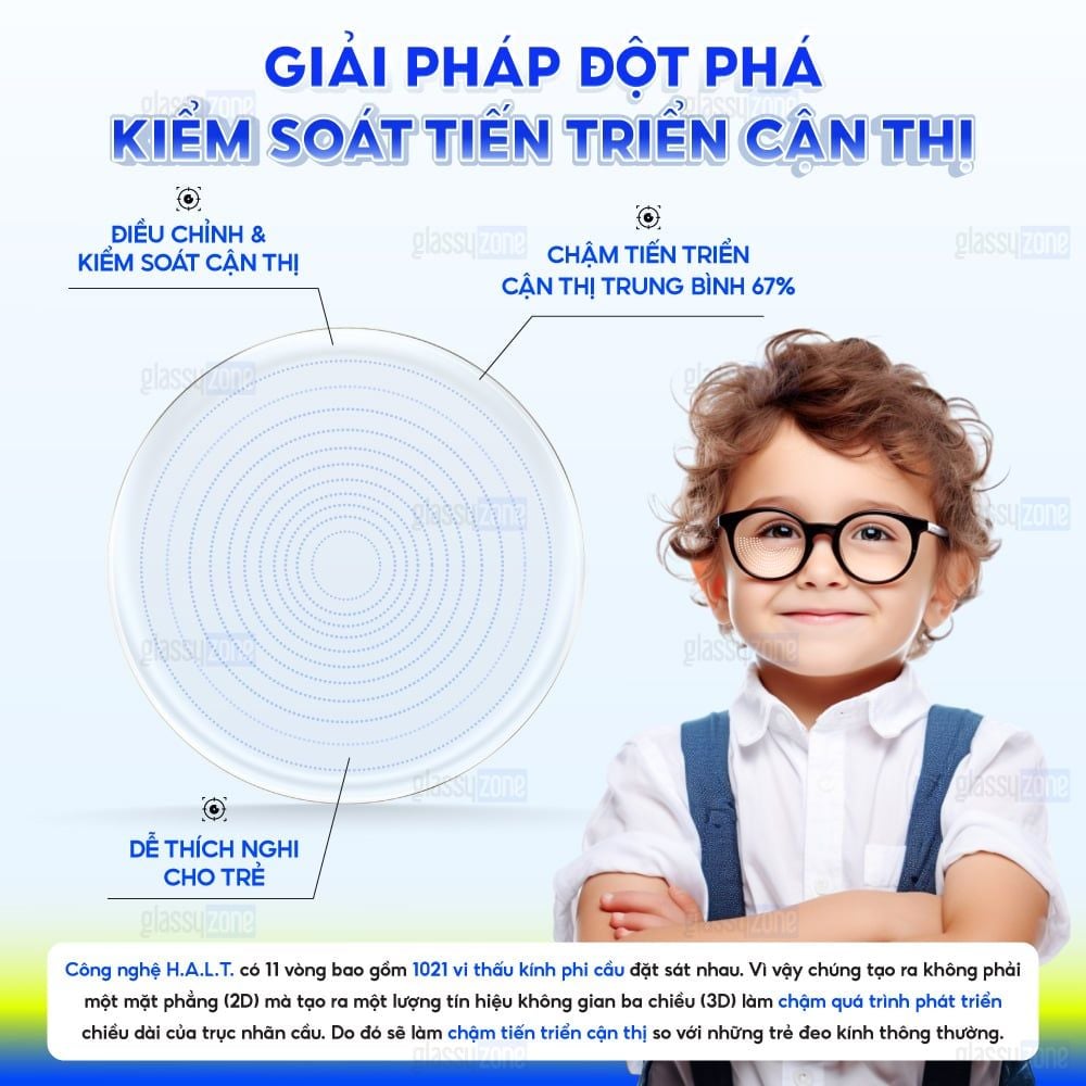 Tròng kính kiểm soát tiến triển cận thị Essilor Stellest 1.59