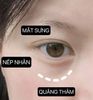 Kem Dưỡng Mắt Jm Solution 40ml