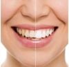 Gel Làm Trắng Răng Crest Whitening Emulsions 10g