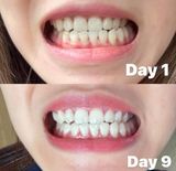 Gel Làm Trắng Răng Crest Whitening Emulsions 10g