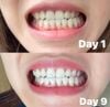 Gel Làm Trắng Răng Crest Whitening Emulsions 10g