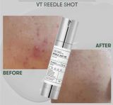  Tinh chất vi kim VT COSMETICS Reedle Shot 100 Essence Tái Tạo Căng Bóng Da 50ml 