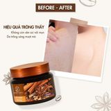  Tẩy Tế Bào Chết Quế Hồi Cafe Bilena Body Scrub Coffee Cloves Cinnamon 380g 