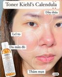 Nước Hoa Hồng Kiehl's Hoa Cúc Calendula Herbal Extract Alcohol-Free Toner 250ml