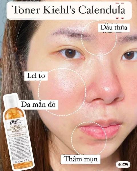 Nước Hoa Hồng Kiehl's Hoa Cúc Calendula Herbal Extract Alcohol-Free Toner 250ml