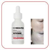  Serum và Kem Dưỡng Medi Peel Glutathione White Ampoule 