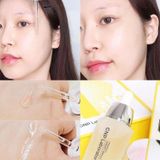 Tinh chất keo ong CNP Propolis Energy Active Ampule 15ml-50ml