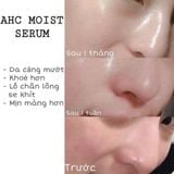 Serum AHC Capture Solution Signature Ampoule 50ml mẫu mới