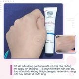 Gel Giảm Mụn Megaduo Azelaic acid & Glycolic acid 15g