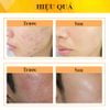 KEM Derma Forte Topical Gel 15g Hỗ Trợ Giảm Mụn, Giảm Thâm