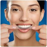  Dán Răng 3D Crest  Professional Effects - 1 Hour Express 